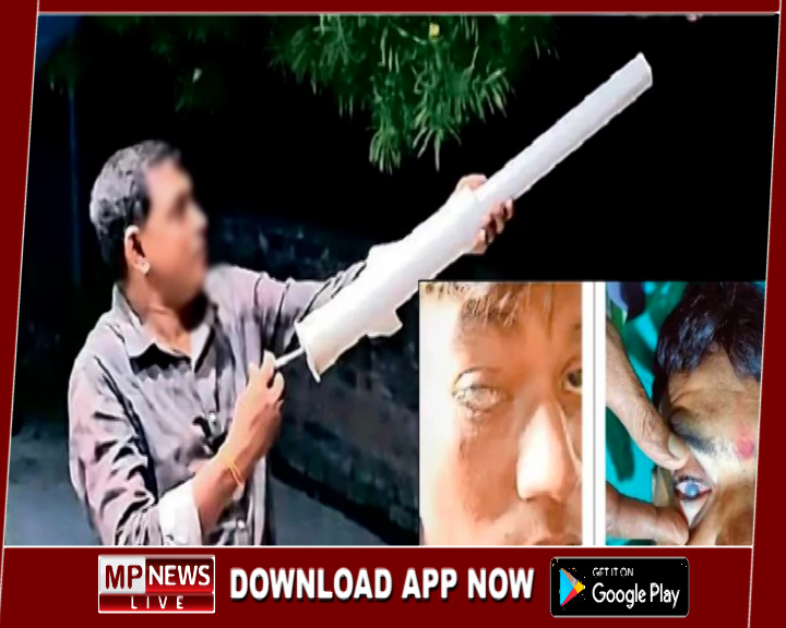 कार्बाइड गन और पटाखों से ग्वालियर में पांच दिनो के अंदर 91 लोगों की आंखें हुई चोटिल